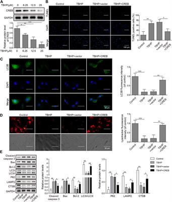 CREB Ameliorates Osteoarthritis Progression Through Regulating Chondrocytes Autophagy via the miR-373/METTL3/TFEB Axis